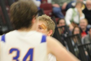 Seen after a foul shot in the fourth quarter, Davis's wound was held together nicely by the work of trainer Jesse Glass.